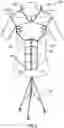 Fig. 21 - TEACHING MODEL FOR BREAST AND ABDOMINAL PROCEDURES