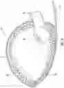 Fig. 17 - Chin rest