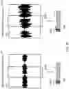 Fig. 13 - Signal processing