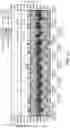 Fig. 04 - DETECTION OF ABNORMAL CHANGES IN FLOW PULSATILITY CLINICALLY CORRELATED WITH ADVERSE EVENTS USING LOGFILE DATA