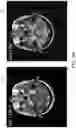 Fig. 07 - METHOD FOR ENHANCING AN ACCURACY OF A BENIGN TUMOR DEVELOPMENT TREND ASSESSMENT SYSTEM