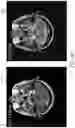 Fig. 08 - METHOD FOR ENHANCING AN ACCURACY OF A BENIGN TUMOR DEVELOPMENT TREND ASSESSMENT SYSTEM