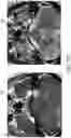 Fig. 09 - METHOD FOR ENHANCING AN ACCURACY OF A BENIGN TUMOR DEVELOPMENT TREND ASSESSMENT SYSTEM