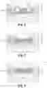 Fig. 04 - Bond pad structure for bonding improvement