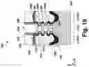 Fig. 20 - Inner spacer liner