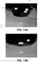 Fig. 23 - Laser assisted metallization process for solar cell fabrication