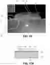 Fig. 26 - Laser assisted metallization process for solar cell fabrication