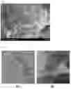 Fig. 04 - Negative electrode and secondary battery including negative electrode