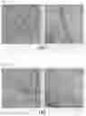 Fig. 05 - Negative electrode and secondary battery including negative electrode