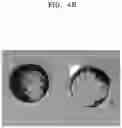 Fig. 11 - All-solid battery and method of preparing the same