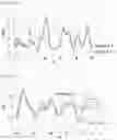 Fig. 07 - Sulfide solid electrolyte