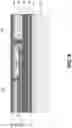 Fig. 14 - Film bulk acoustic resonator structure and fabricating method