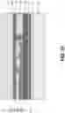Fig. 15 - Film bulk acoustic resonator structure and fabricating method