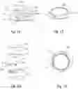 Fig. 09 - Articulated grip for mobile handheld device