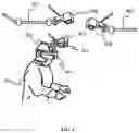 Fig. 05 - Augmented reality guidance for bone removal and osteotomies in spinal surgery including deformity correction