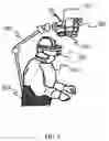 Fig. 06 - Augmented reality guidance for bone removal and osteotomies in spinal surgery including deformity correction