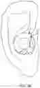 Fig. 14 - Ringed-shaped biometric earpiece