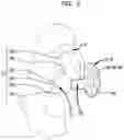 Fig. 03 - Three-dimensional earpiece production system