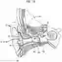 Fig. 09 - Three-dimensional earpiece production system