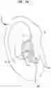 Fig. 10 - Three-dimensional earpiece production system