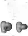 Fig. 03 - Bluetooth earphone