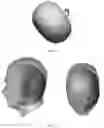 Fig. 13 - Bluetooth earphone