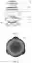 Fig. 05 - Loudspeaker system, loudspeaker, and loudspeaker base