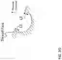 Fig. 10 - BONE CONDUCTION IMPLANT