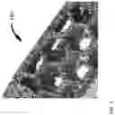 Fig. 18 - BONE CONDUCTION IMPLANT