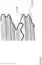 Fig. 33 - BONE CONDUCTION IMPLANT