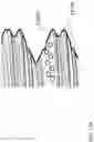 Fig. 34 - BONE CONDUCTION IMPLANT