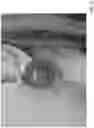 Fig. 36 - Personal sound amplification article and method for implementing same