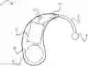 Fig. 01 - METHOD FOR SUPPORTING THE USE OF A HEARING AID, AND HEARING AID