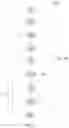 Fig. 07 - APPARATUS AND METHOD FOR PRELOADING A PLURALITY OF FEED TYPES OF A FEED MIX FOR LIVESTOCK AND METHOD FOR PREPARING FEED MIXES