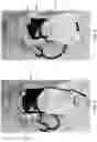 Fig. 04 - ARTICLE OF INFANT CLOTHING