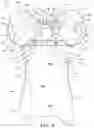Fig. 07 - Support shirts including a restriction panel