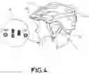 Fig. 04 - PROTECTIVE DEVICE FOR PROTECTING A USER' S HEAD AND NECK AREA AGAINST AN IMMINENT IMPACT