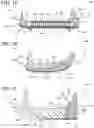Fig. 17 - Sole structure for article of footwear
