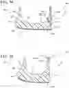 Fig. 27 - Sole structure for article of footwear