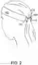 Fig. 03 - HAIR RETAINER AND METHODS OF USE