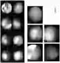 Fig. 03 - Methods and Systems for Cystoscopic Imaging Incorporating Machine Learning