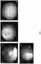 Fig. 04 - Methods and Systems for Cystoscopic Imaging Incorporating Machine Learning
