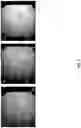Fig. 06 - Methods and Systems for Cystoscopic Imaging Incorporating Machine Learning