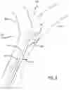 Fig. 10 - Steerable fiber optic shape sensing enabled elongated medical instrument