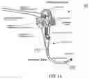 Fig. 02 - ENDOSCOPIC DEVICE WITH ADDITIONAL CHANNEL