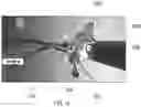 Fig. 12 - ENDOSCOPIC DEVICE WITH ADDITIONAL CHANNEL