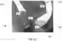 Fig. 28 - ENDOSCOPIC DEVICE WITH ADDITIONAL CHANNEL