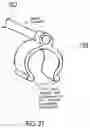 Fig. 29 - ENDOSCOPIC DEVICE WITH ADDITIONAL CHANNEL