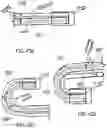 Fig. 44 - ENDOSCOPIC DEVICE WITH ADDITIONAL CHANNEL