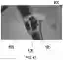 Fig. 45 - ENDOSCOPIC DEVICE WITH ADDITIONAL CHANNEL